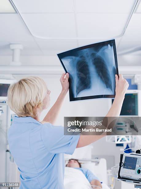 nurse reviewing x-ray - respiratory system stock pictures, royalty-free photos & images