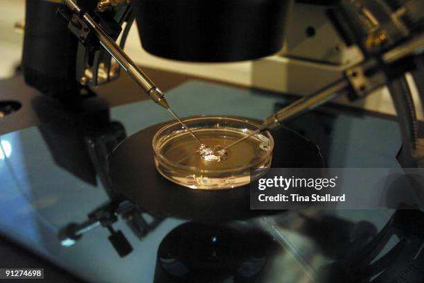 Sperm fertilizes an egg under a microscope using ICSI as part of IVF treatment at the private Lister Hospital. One needle holds the egg in position...