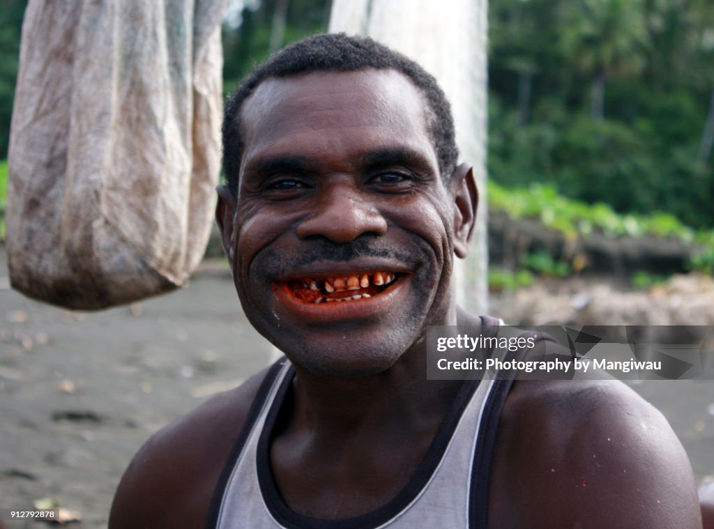 Betel Nut Teeth betel-nut-teeth
