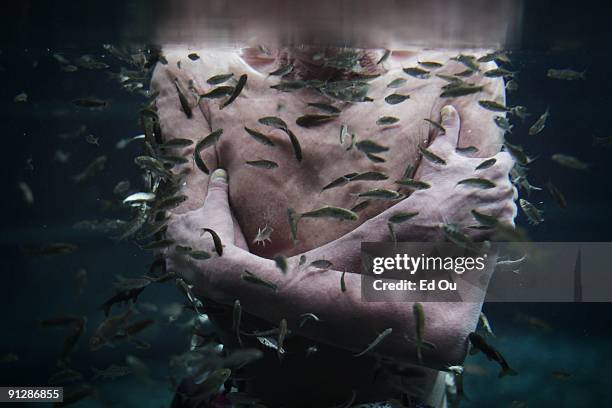 Doctor fish' eat the dead skin off of a German psoriasis patient Aslan Gungor as part of his treatment on September 14, 2009 in Kangal, 105...