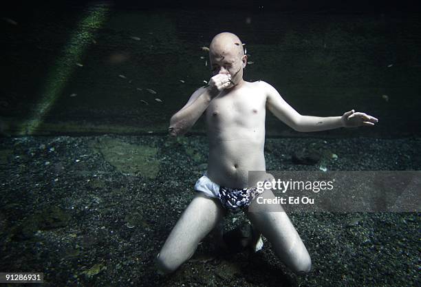 Doctor fish' eat the dead skin off of Polish psoriasis patient Michal Lisiak as part of his treatment on September 14, 2009 in Kangal, 105 kilometers...