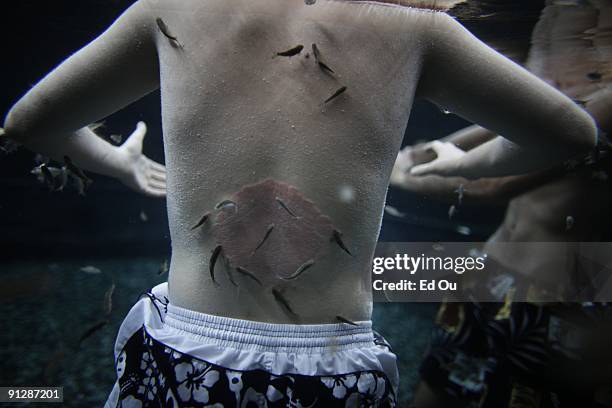 Doctor fish' eat the dead skin off of Polish psoriasis patient Michal Lisiak as part of his treatment on September 13, 2009 in Kangal, 105 kilometers...