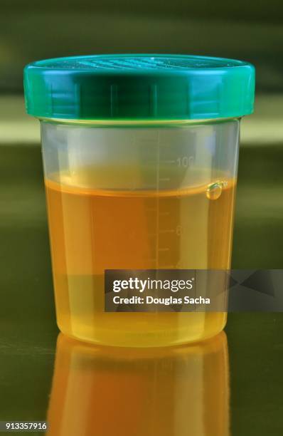 human urine sample in a sealed container - testbild stock-fotos und bilder