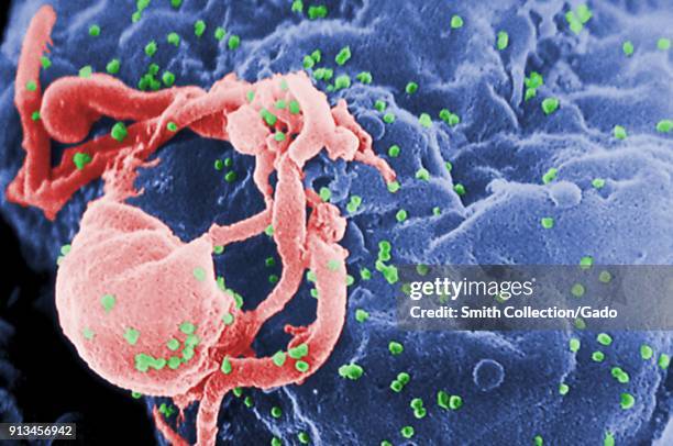 Scanning electron micrograph of HIV-1 virions as green round bumps budding from the surface of a cultured lymphocyte cell, 1985. Image courtesy...