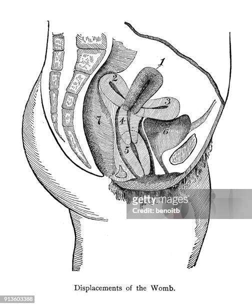 illustrations, cliparts, dessins animés et icônes de déplacements de l’utérus - gros intestin humain