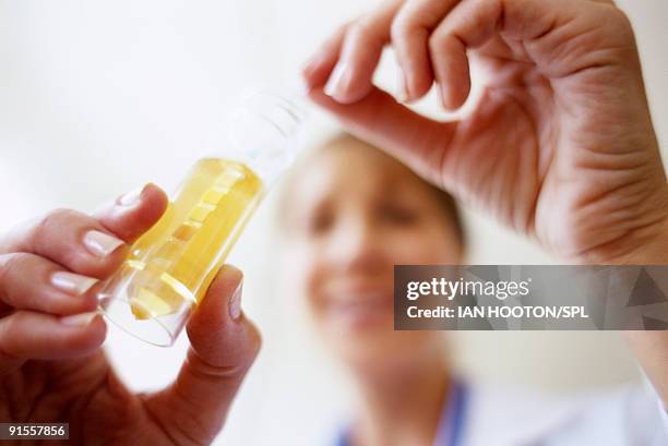doctor placing multiple test stick into urine sample - urine sample ストックフォトと画像