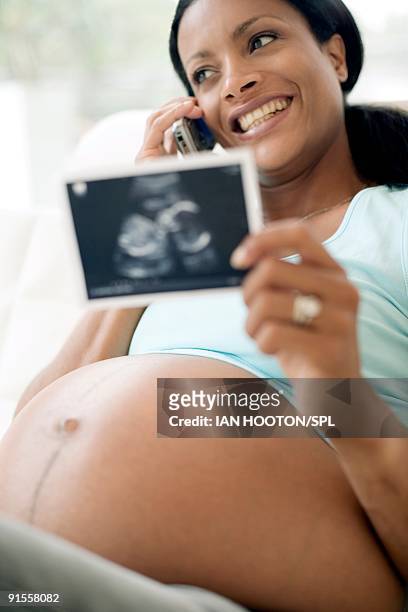pregnant woman holding ultrasound scan of unborn child - ultra sonography stock pictures, royalty-free photos & images