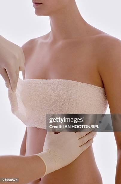 cosmetic surgeon applying protective bandage round client breasts after surgery - aumento dos seios imagens e fotografias de stock