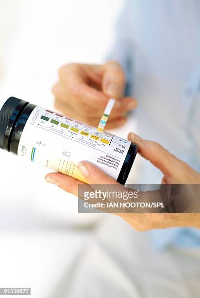 nurse performing urine analysis, close-up - dipstick stock pictures, royalty-free photos & images
