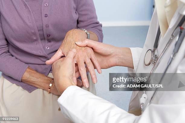 rheumatoid arthritis, general practitioner examining patient and hand for signs of rheumatoid arthri - arthritis hands stock-fotos und bilder