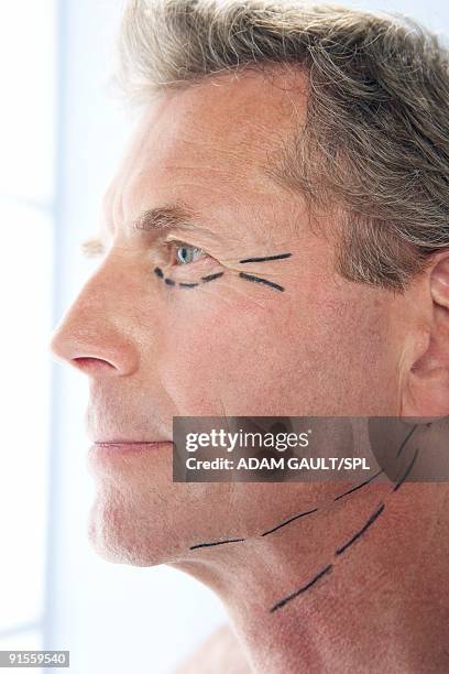 mature man with incision marks on face, close-up - incision stock pictures, royalty-free photos & images
