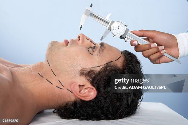 human hand holding vernier caliper to measure patients nose - nasenkorrektur stock-fotos und bilder