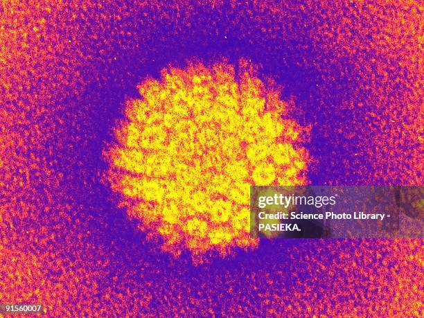 illustrazioni stock, clip art, cartoni animati e icone di tendenza di human papilloma virus - micrografia elettronica in trasmissione