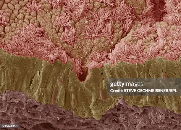 trachea mucous membrane - scanning electron micrograph stock-grafiken, -clipart, -cartoons und -symbole