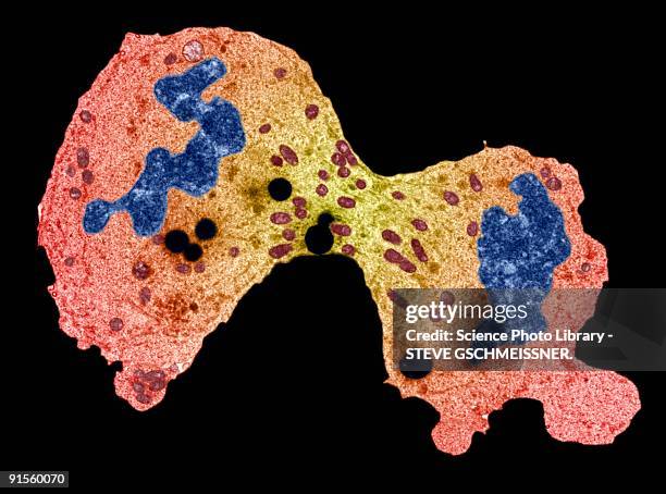 illustrazioni stock, clip art, cartoni animati e icone di tendenza di cancer cell division - micrografia elettronica in trasmissione