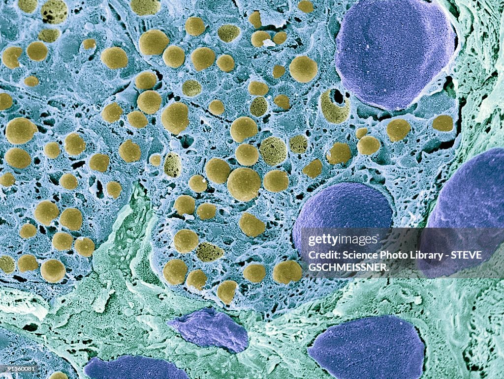Pancreas tissue, colored scanning electron micrograph