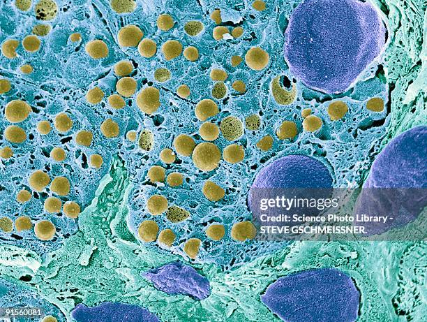 pancreas tissue, colored scanning electron micrograph - magnification stock illustrations