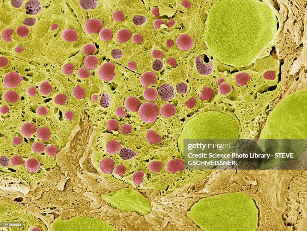 Pancreas tissue, colored scanning electron micrograph