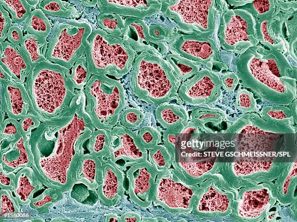 nerve fibers, scanning electron micrograph - neural axon点のイラスト素材／クリップアート素材／マンガ素材／アイコン素材