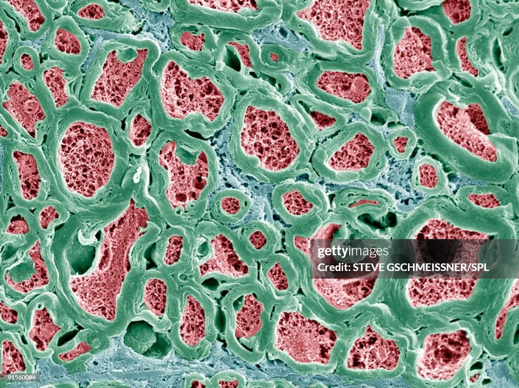Nerve fibers, scanning electron micrograph