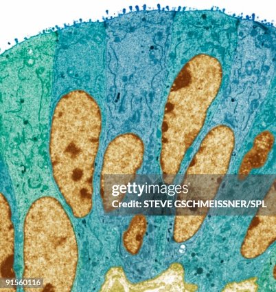 Fallopian tube, colored transmission electron micrograph (TEM) Fallopian tube, colored transmission electron micrograph (TEM)