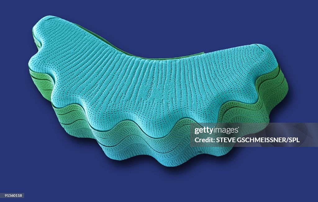 Diatom, colored scanning electron micrograph (SEM)