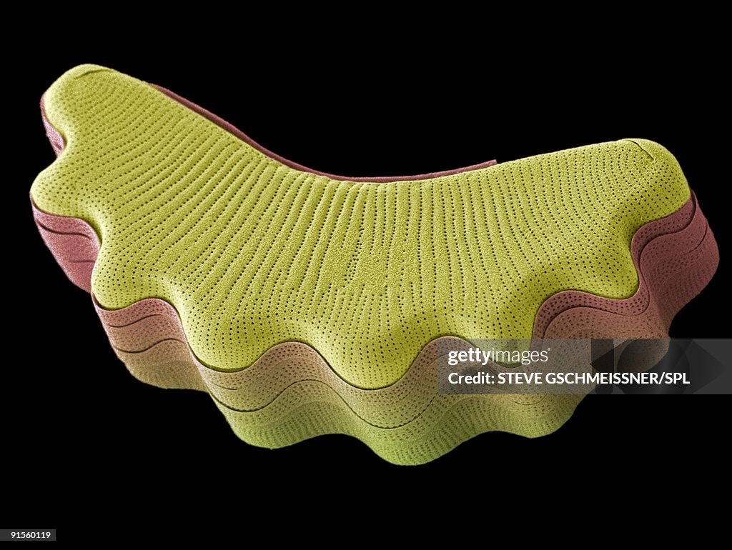 Diatom, colored scanning electron micrograph (SEM)