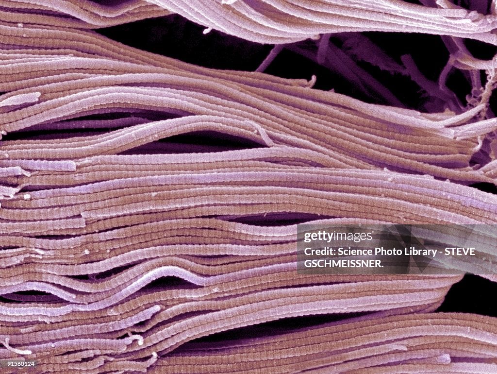 Collagen, Scanning electron micrograph (SEM)