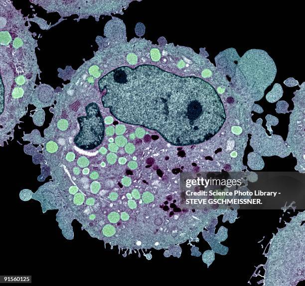 carcinoma cell, colored transmission electron micrograph (tem) - lipid stock-grafiken, -clipart, -cartoons und -symbole