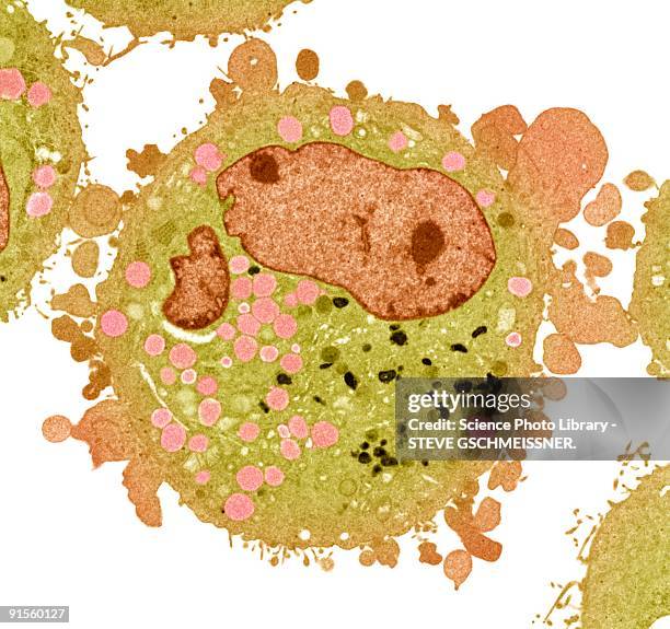 carcinoma cell, colored transmission electron micrograph (tem) - lysosome stock illustrations