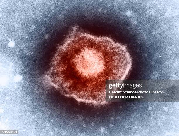 varicella zoster virus (vzv) particle, colored transmission electron micrograph (tem) - varicella zoster virus stock illustrations