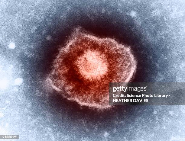 varicella zoster virus (vzv) particle, colored transmission electron micrograph (tem) - tem 幅插畫檔、美工圖案、卡通及圖標