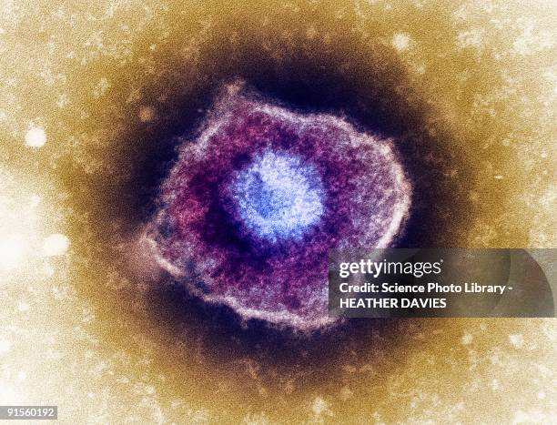 varicella zoster virus (vzv) particle, colored transmission electron micrograph (tem) - varicella zoster virus stock illustrations