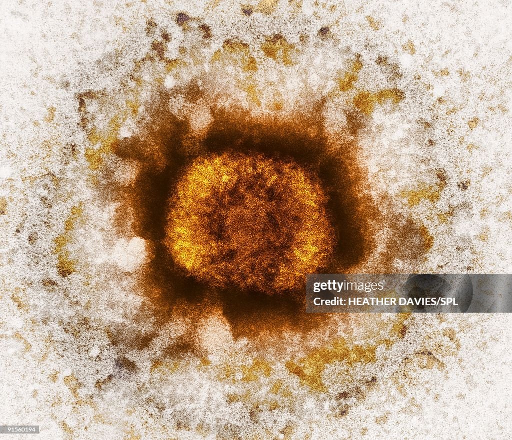Vaccinia Virus Particle (VV), colored transmission electron micrograph (TEM)