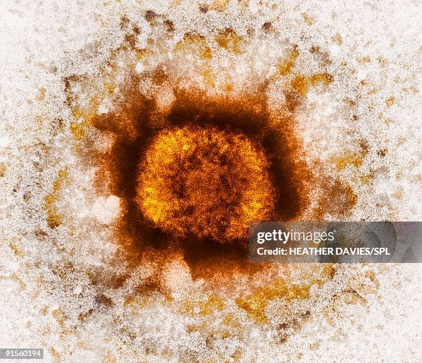 vaccinia virus particle (vv), colored transmission electron micrograph (tem) - capsid stock illustrations