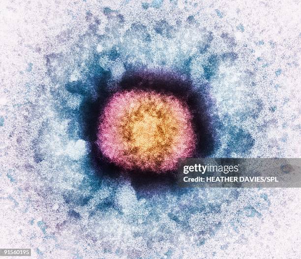 ilustraciones, imágenes clip art, dibujos animados e iconos de stock de vaccinia virus particle (vv), colored transmission electron micrograph (tem) - cápside