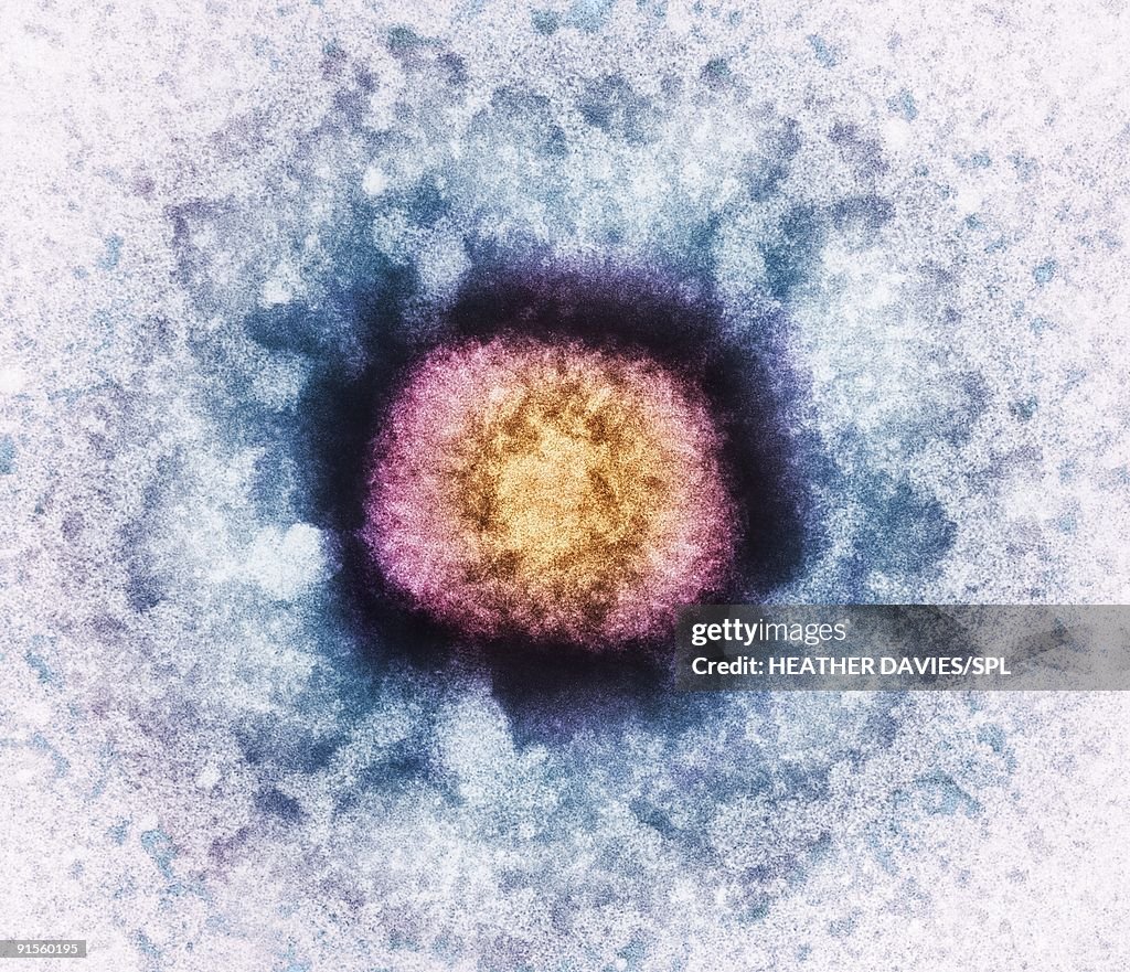 Vaccinia Virus Particle (VV), colored transmission electron micrograph (TEM)
