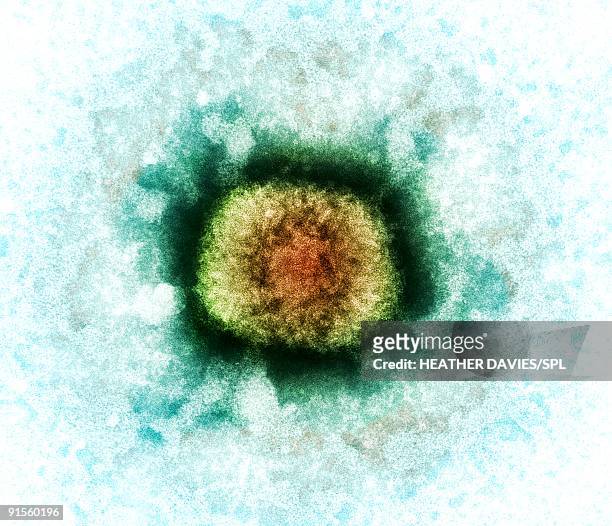 vaccinia virus particle (vv), colored transmission electron micrograph (tem) - smallpox virus stock-grafiken, -clipart, -cartoons und -symbole
