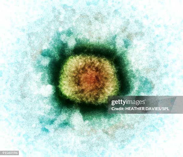 vaccinia virus particle (vv), colored transmission electron micrograph (tem) - capsid stock illustrations