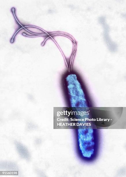 bildbanksillustrationer, clip art samt tecknat material och ikoner med helicobacter pylori bacterium, colored transmission electron micrograph (tem) - tem