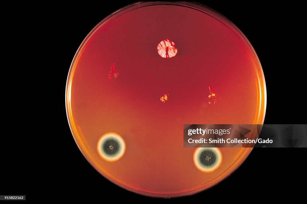 Trichophyton Concentricum