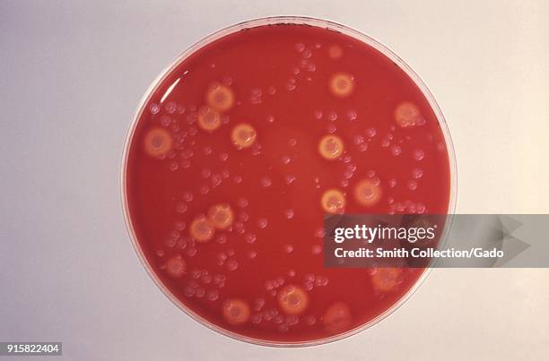 Blood agar culture plate growing Bacillus anthracis and other soil flora, 1980. Image courtesy Centers for Disease Control / Dr James Feely. Image...
