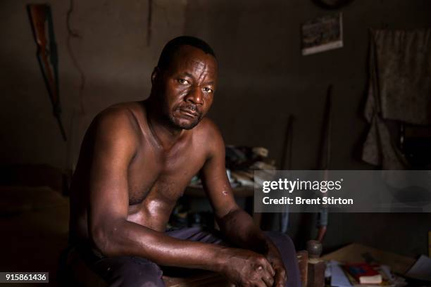 Alphonse Saboundou a teacher who supplements his meagre income with bushmeat hunting, is seen recovering from his injuries at the hands of Seleka in...
