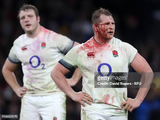 Dylan Hartley of England looks on injured during the NatWest Six Nations round two match between England and Wales at Twickenham Stadium on February...