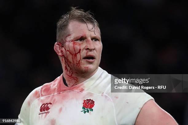 Dylan Hartley, the England captain, is covered in blood after injurying his ear during the NatWest Six Nations match between England and Wales at...