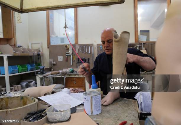 Man views a prosthetic leg at a rehabilitation center in Erbil, Iraq on February 11, 2018. The rehabilitation center serves since 1996 within the...