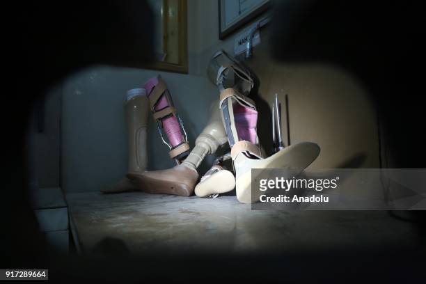 Prosthetic legs are seen at a rehabilitation center in Erbil, Iraq on February 11, 2018. The rehabilitation center serves since 1996 within the body...