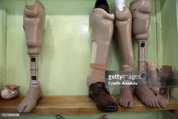 Prosthetic legs are seen at a rehabilitation center in Erbil, Iraq on February 11, 2018. The rehabilitation center serves since 1996 within the body...