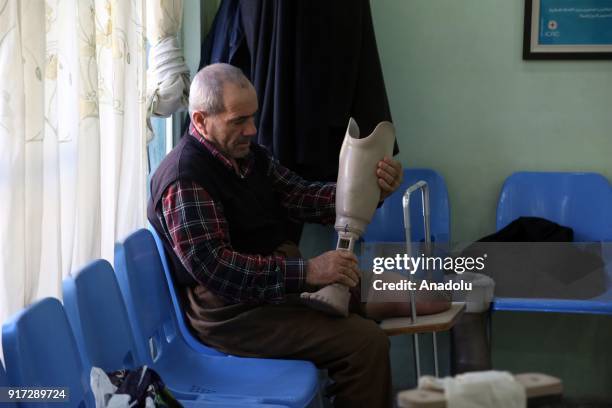 Man, missing a leg, holds a prosthetic leg at a rehabilitation center in Erbil, Iraq on February 11, 2018. The rehabilitation center serves since...