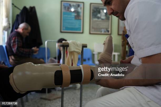 Man works on a prosthetic leg at a rehabilitation center in Erbil, Iraq on February 11, 2018. The rehabilitation center serves since 1996 within the...